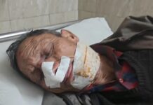 एसटीएफ के कांस्टेबल और काश्तकार को लगी गोली, एसएसपी ने दी जानकारी, देखें वीडियो