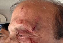 निदेशालय में शिक्षा निदेशक पर जानलेवा हमला